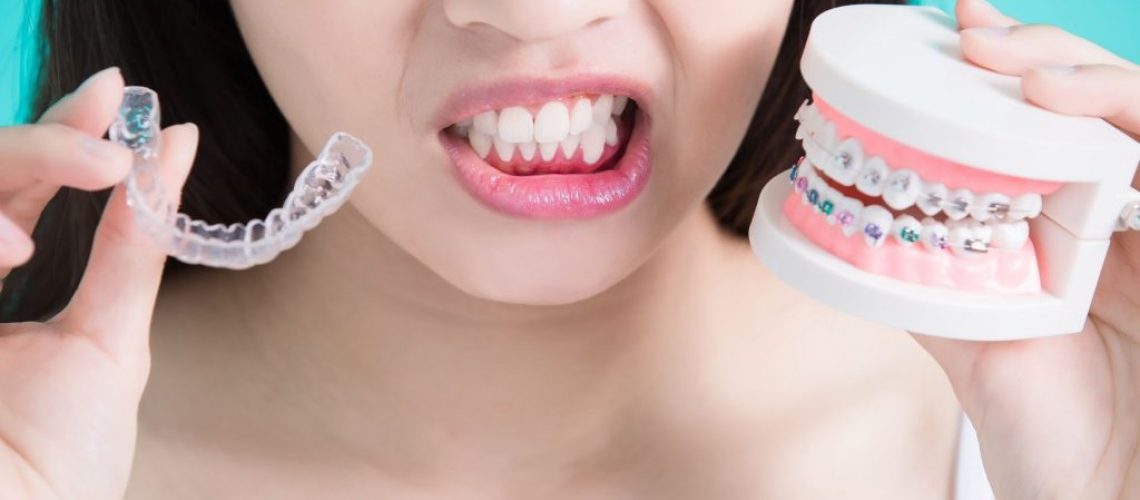 alienadores_invisible_o_brakets